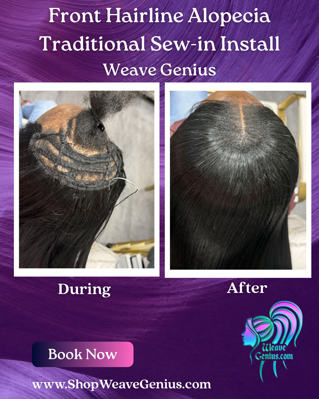 Traditional Sew-in or Versatile Sew-in Install | Stuart FL