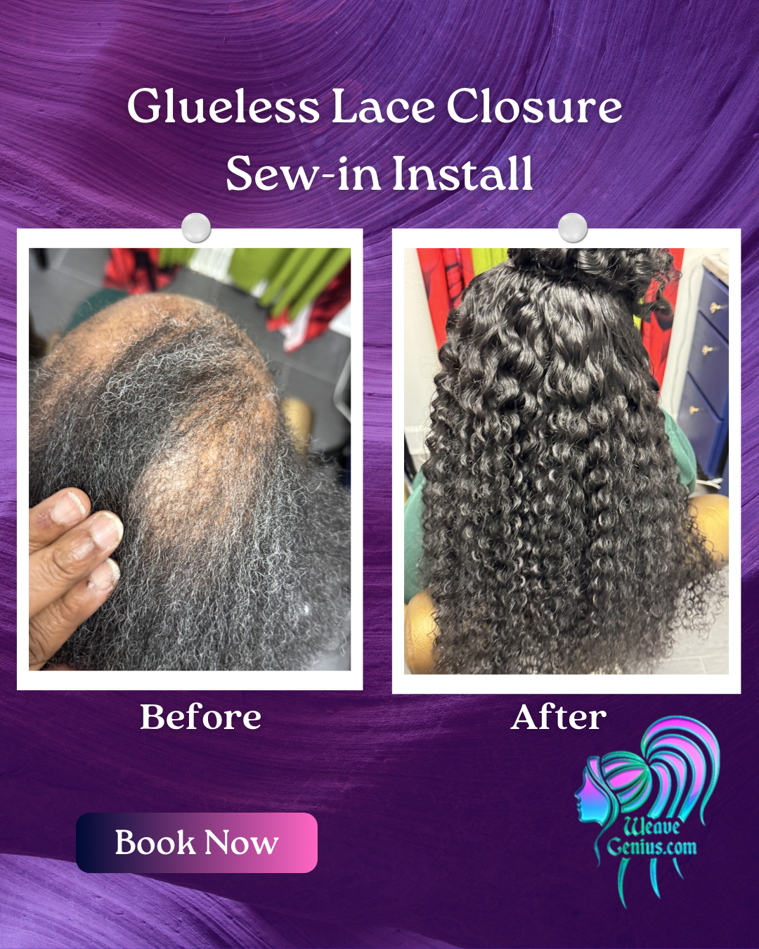 Alopecia Sew-in Install | Stuart FL