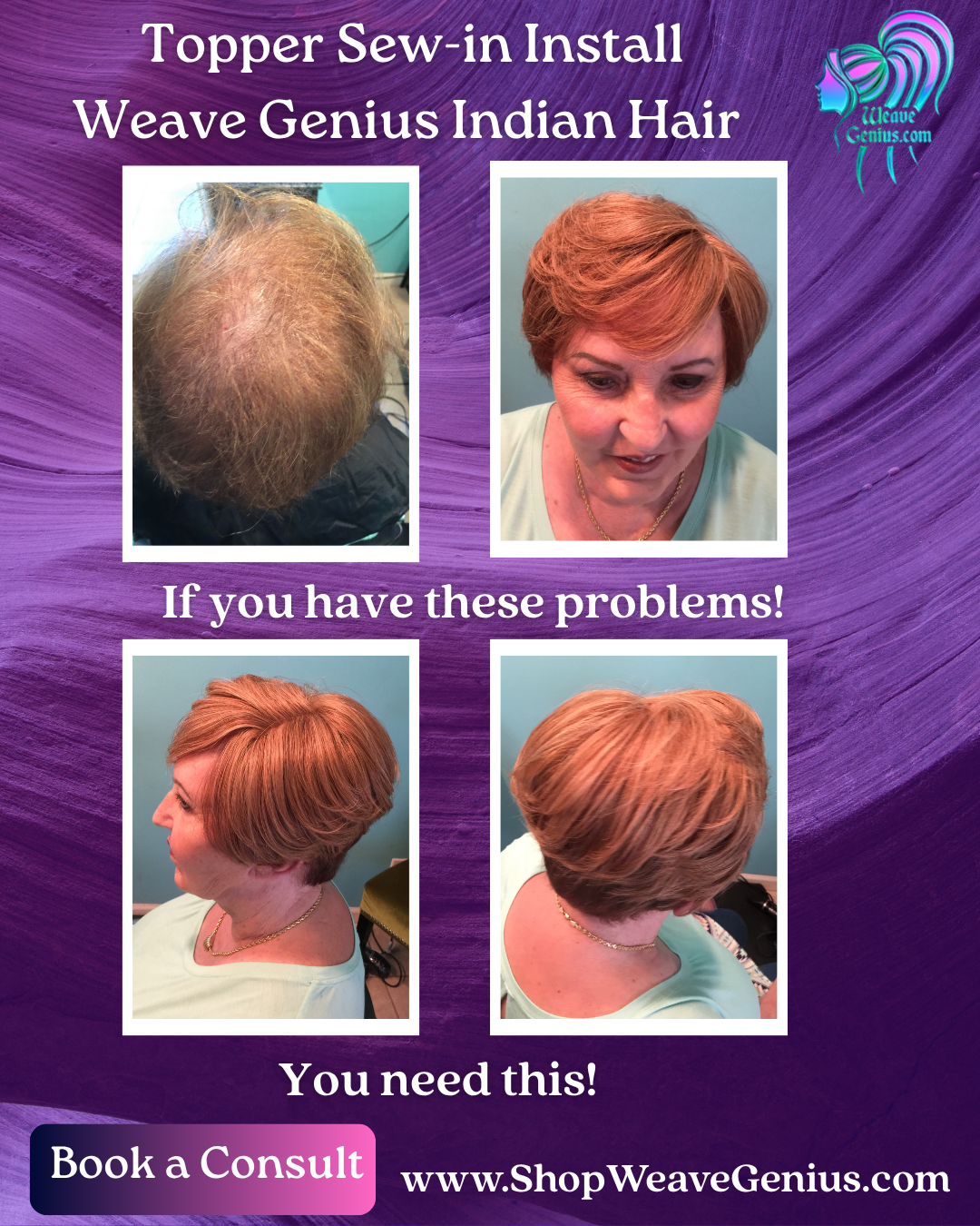 Hair Replacement Topper with Install & Topper Included | Jacksonville FL