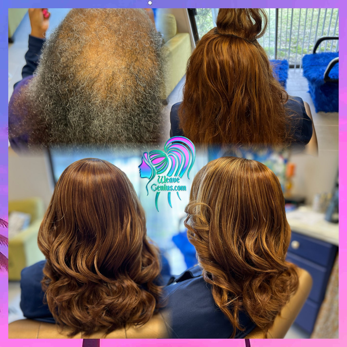 Alopecia Sew-in Install | Ft Lauderdale FL