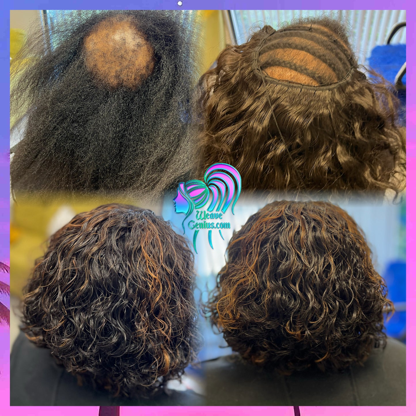 Alopecia Sew-in Install | Jacksonville Fl