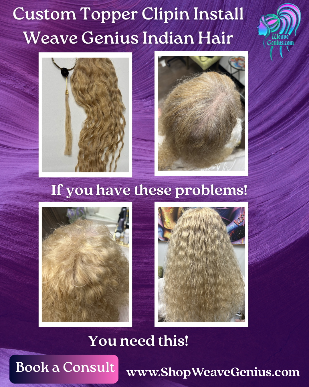 Hair Replacement Topper Install | Jacksonville FL