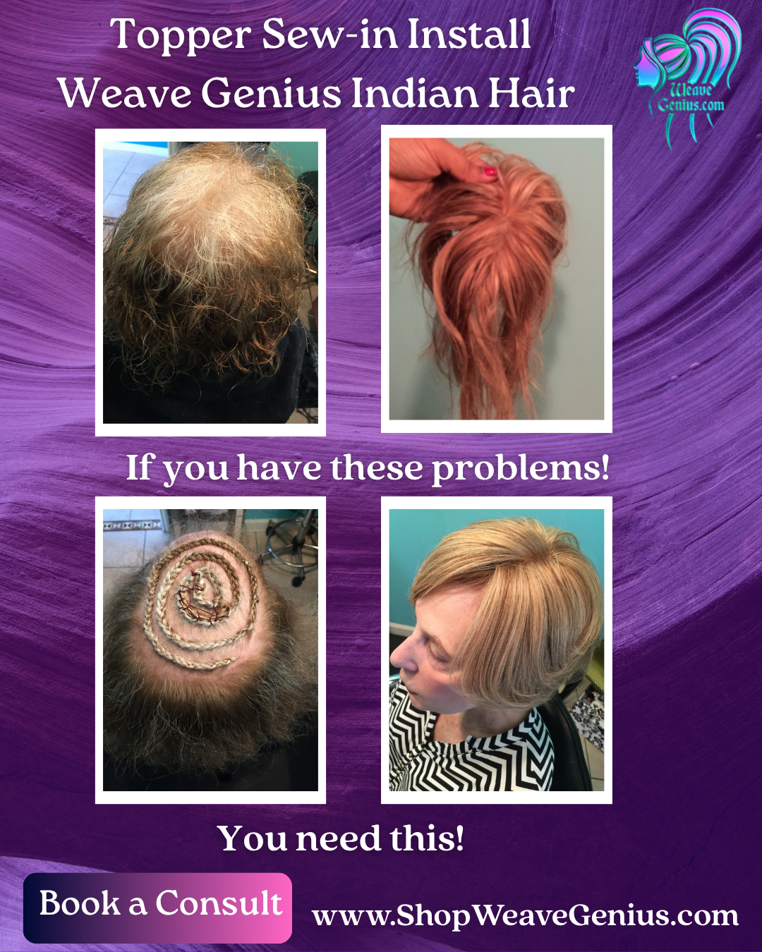 Hair Replacement Topper Install | Jacksonville FL